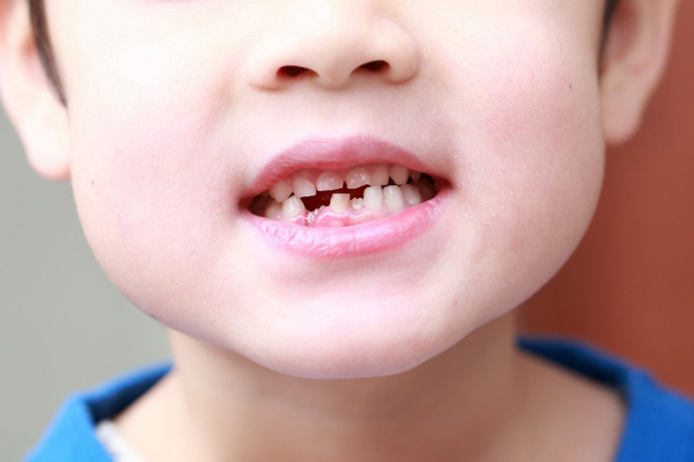 お子様の歯並びでお悩みではありませんか？